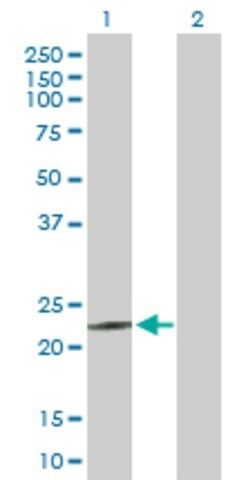 Anti-MED18 antibody produced in rabbit