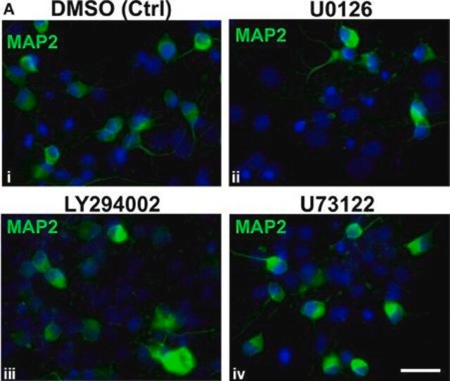 Anti-MAP2 Antibody, clone AP20