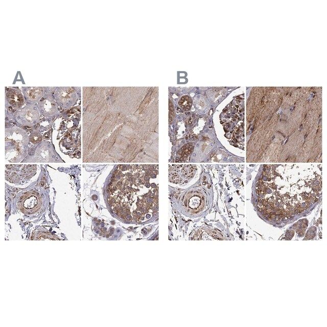 Anti-MAP4 antibody produced in rabbit