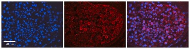 Anti-MAPK1 (C-terminal) antibody produced in rabbit