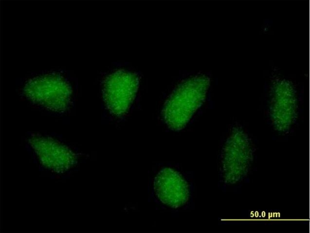 Anti-MAPK11 antibody produced in mouse