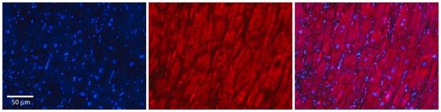 Anti-LPL (C-terminal) antibody produced in rabbit