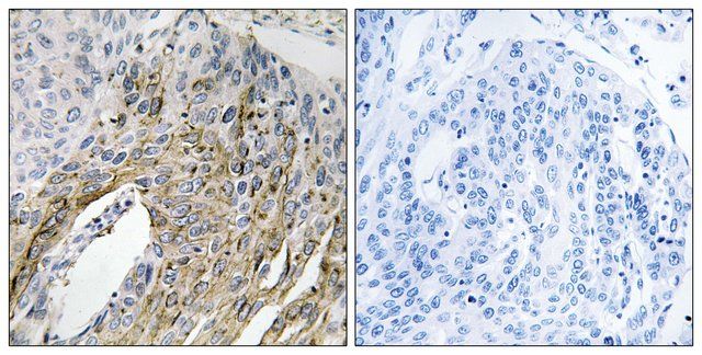 Anti-LONP2 antibody produced in rabbit