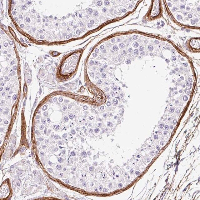 Anti-LOXL4 antibody produced in rabbit