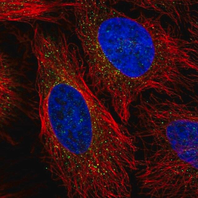 Anti-LPL antibody produced in rabbit