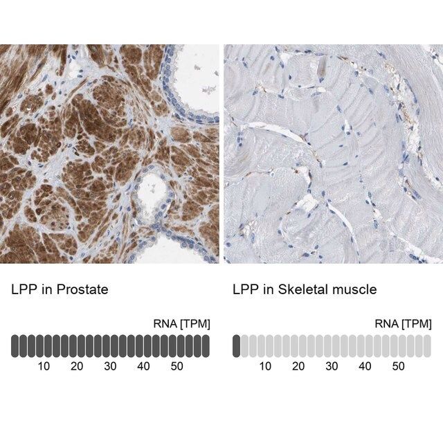 Anti-LPP antibody produced in rabbit