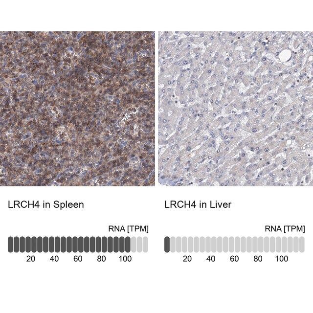 Anti-LRCH4 antibody produced in rabbit