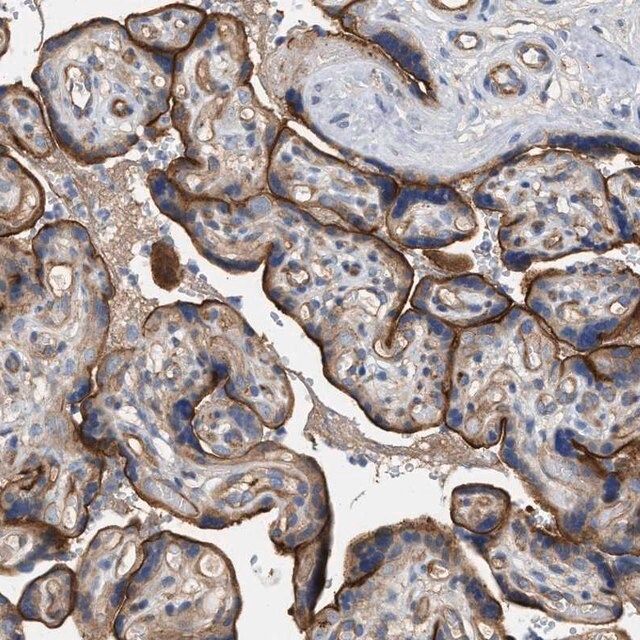 Anti-LRCH1 antibody produced in rabbit