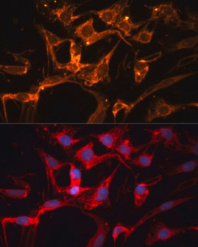 Anti-LPL antibody produced in rabbit