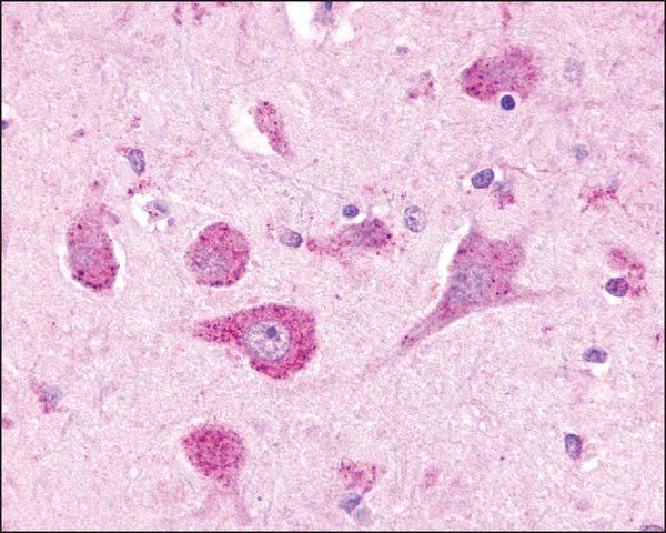 Anti-LPHN3 antibody produced in rabbit