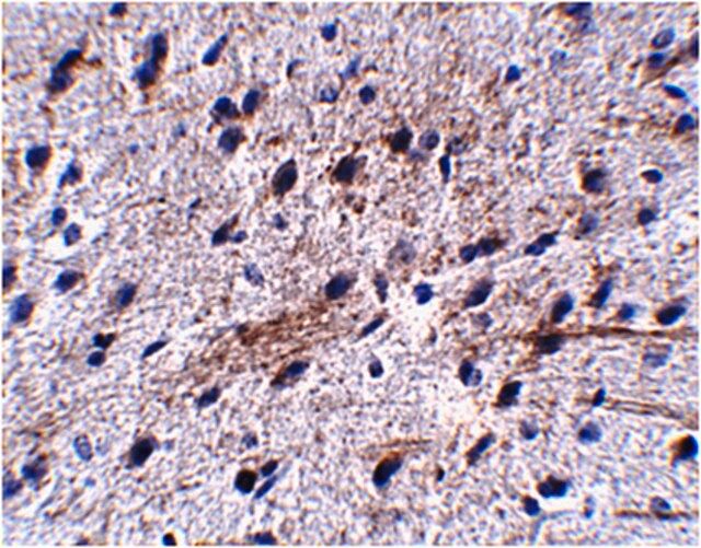 Anti-LRFN5 Antibody