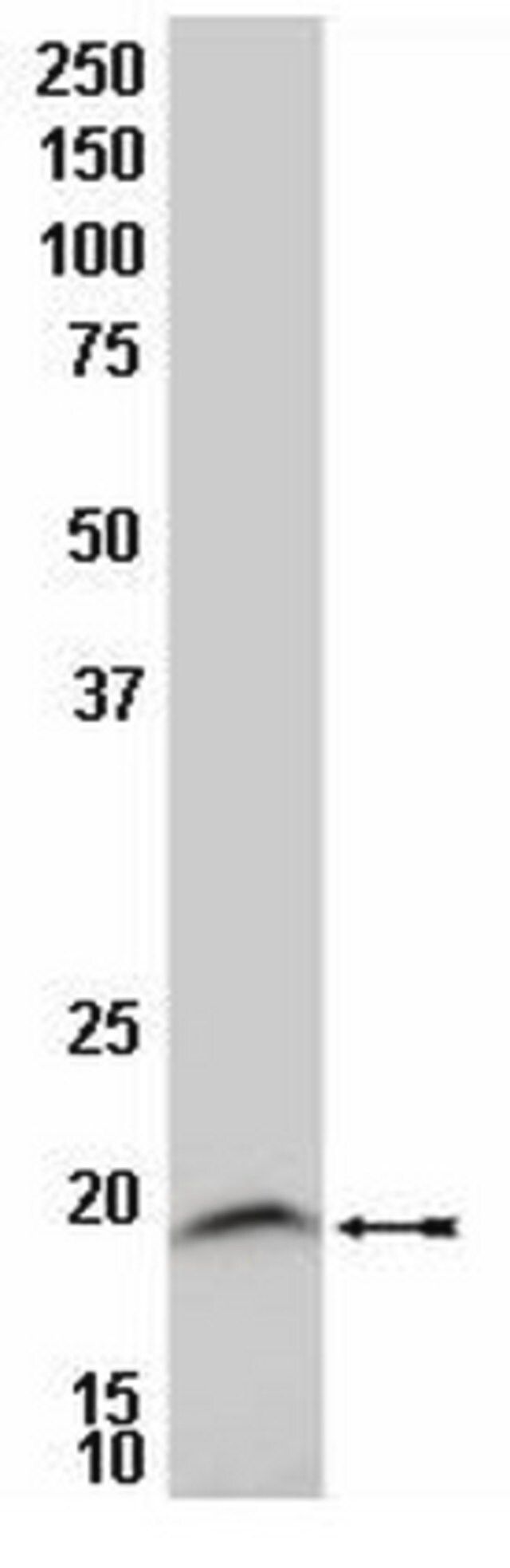 Anti-LIM Domain Only 2 Antibody, clone 2E6