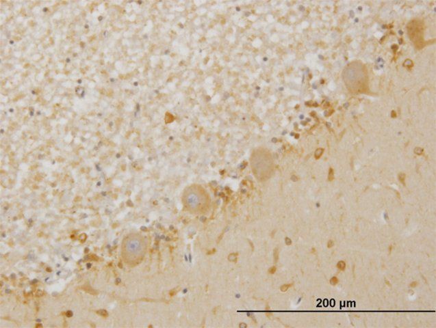ANTI-LIMK1 antibody produced in mouse