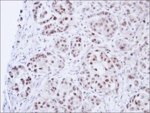 Anti-LIG3 antibody produced in rabbit