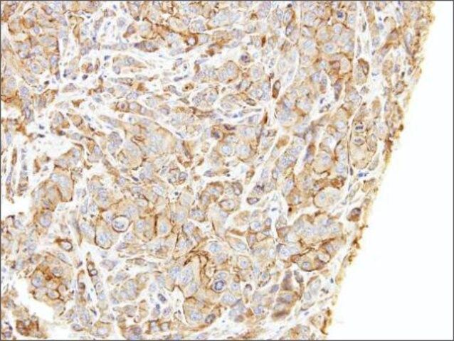 Anti-LIMCH1 (C-terminal) antibody produced in rabbit