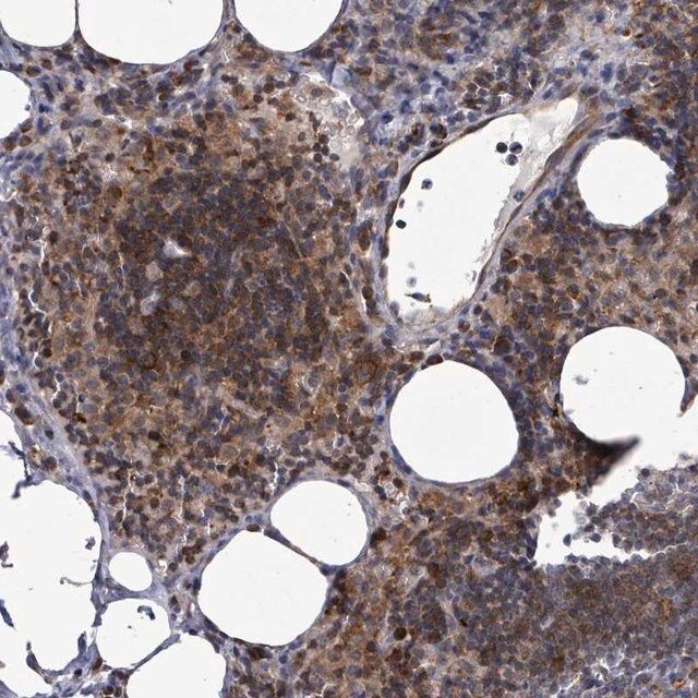 Anti-LILRA4 antibody produced in rabbit