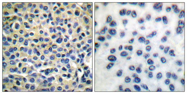 Anti-LIMK1 antibody produced in rabbit