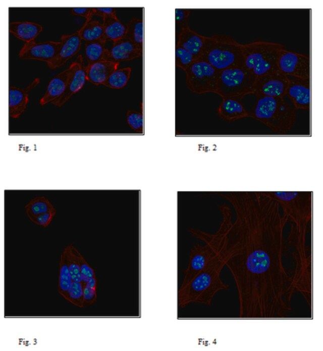 Anti-Ligand-dependent nuclear receptor-interacting factor 1 Antibody