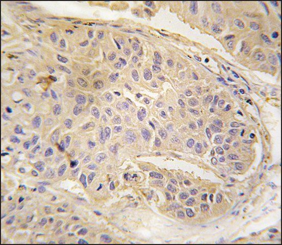 Anti-LIN28A (C-term) antibody produced in rabbit