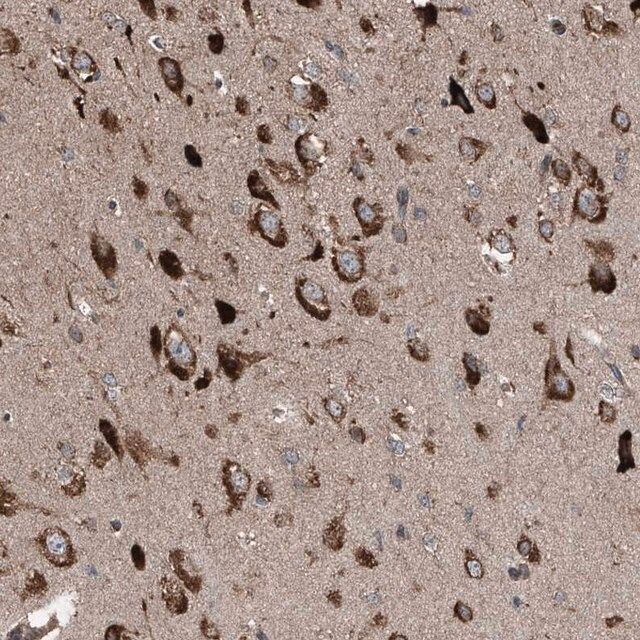 Anti-LIMK1 antibody produced in rabbit