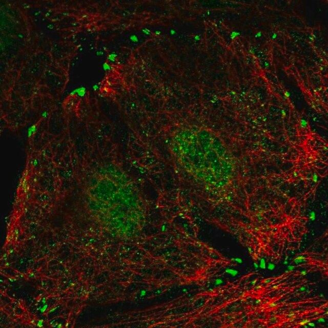 Anti-LIMD1 antibody produced in rabbit
