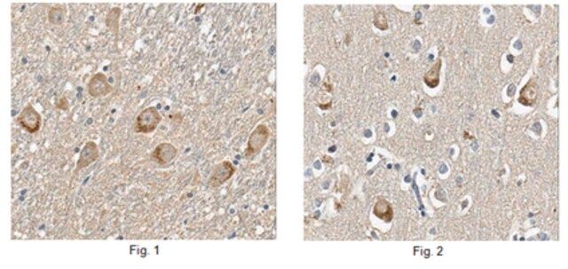 Anti-Limk1 Antibody, clone 6C3.1| MABN118
