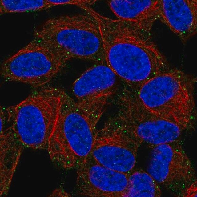 Anti-LIMD2 antibody produced in rabbit