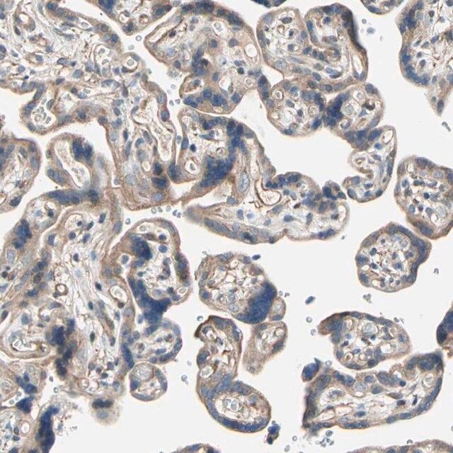 Anti-LIMK2 antibody produced in rabbit