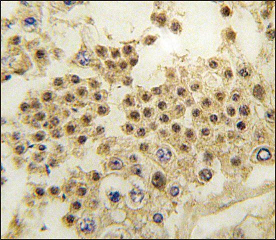 Anti-LIN28A (N-term) antibody produced in rabbit