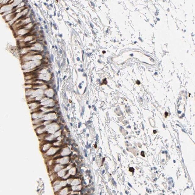 Anti-LIMCH1 antibody produced in rabbit