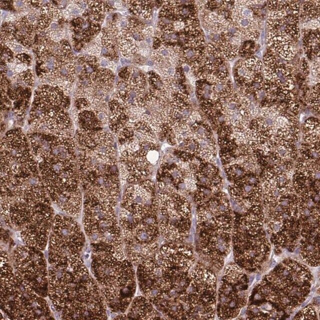 Anti-LIMS1 antibody produced in rabbit