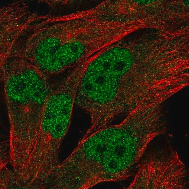Anti-LINC00493 antibody produced in rabbit