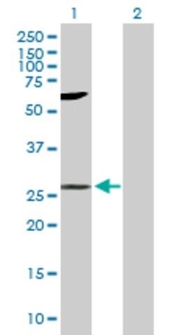 Anti-LIN7A antibody produced in mouse