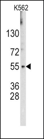 Anti-LIN28B (center) antibody produced in rabbit