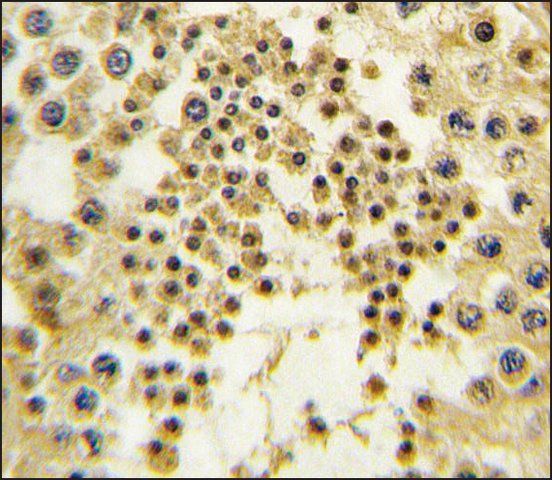 Anti-LIN28B (C-term) antibody produced in rabbit