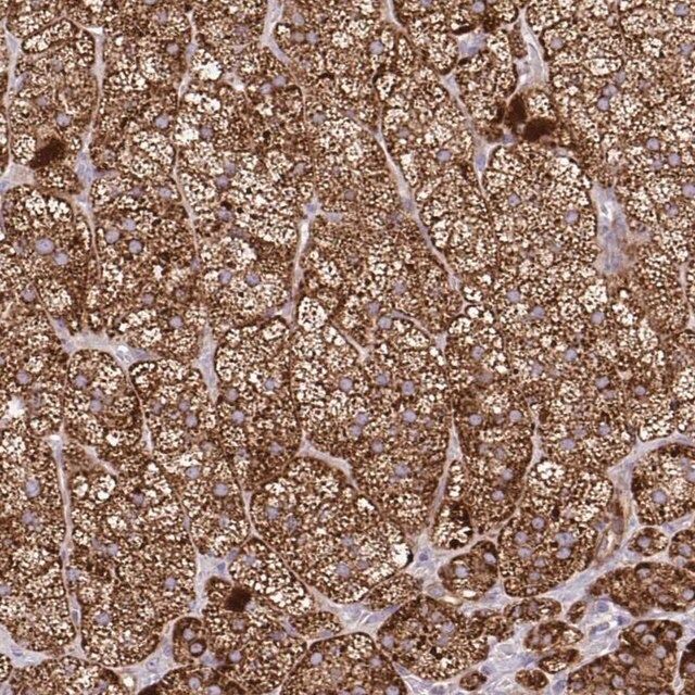 Anti-LIMS1 antibody produced in rabbit