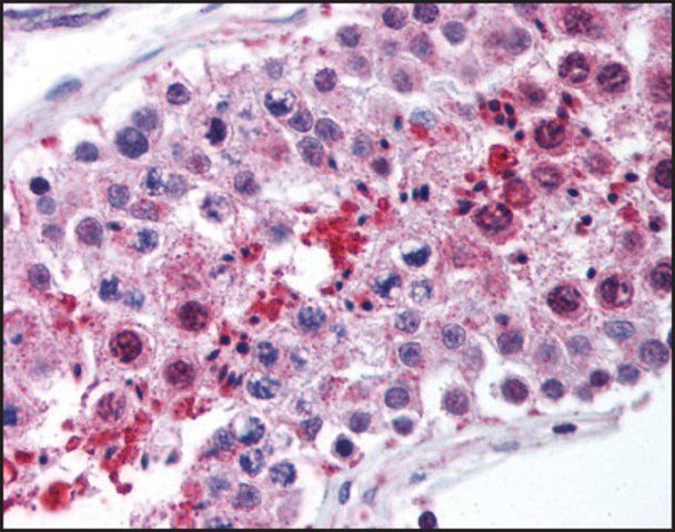 Anti-LIPE antibody produced in rabbit