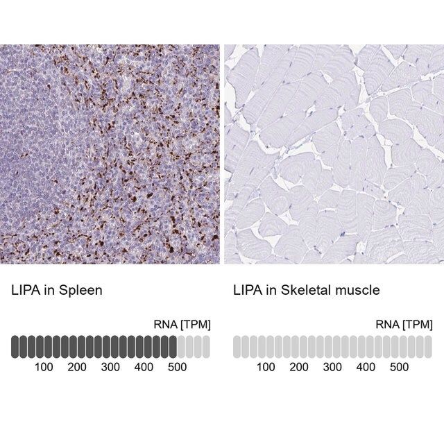 Anti-LIPA antibody produced in rabbit