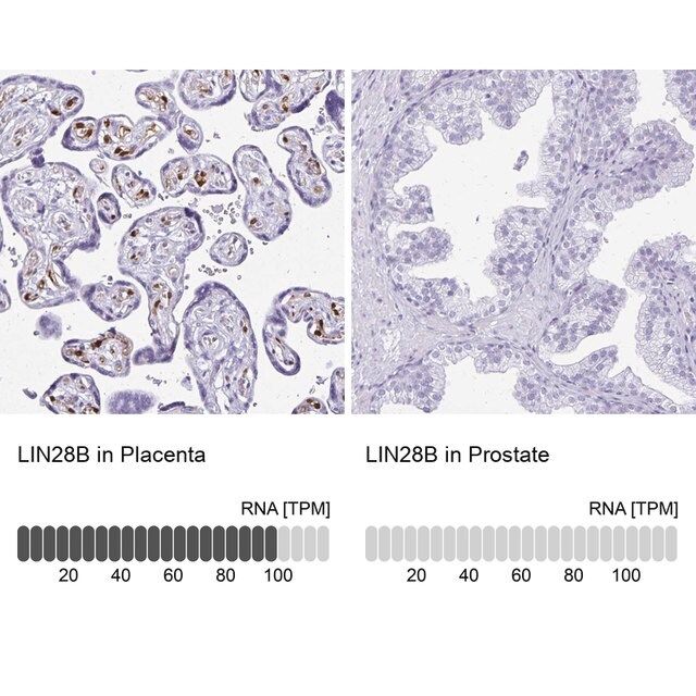 Anti-LIN28B antibody produced in rabbit