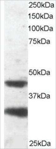 Anti-LIS1/PAFAH1B1 antibody produced in goat