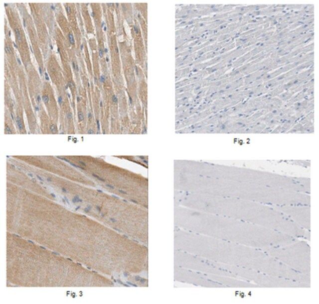 Anti-Lipin-1 Antibody
