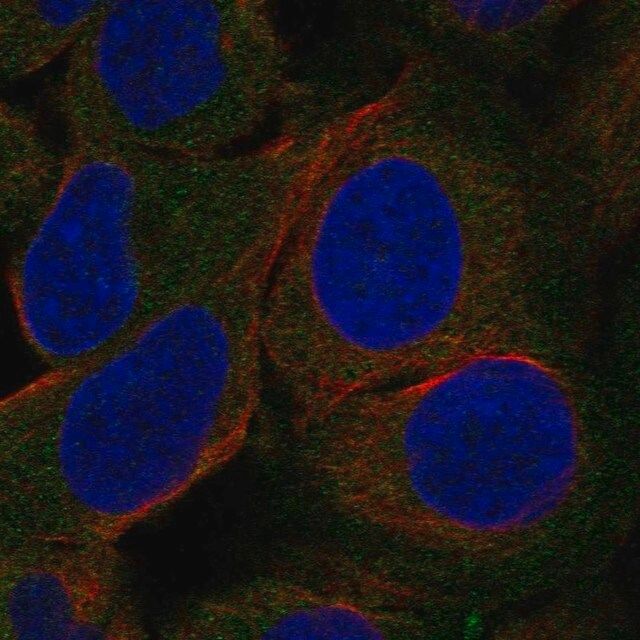 Anti-LIPE antibody produced in rabbit