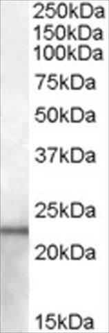 Anti-Lipocalin 2/NGAL (AB2) antibody produced in goat
