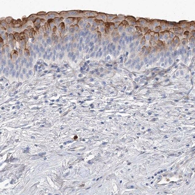 Anti-LIMK1 antibody produced in rabbit