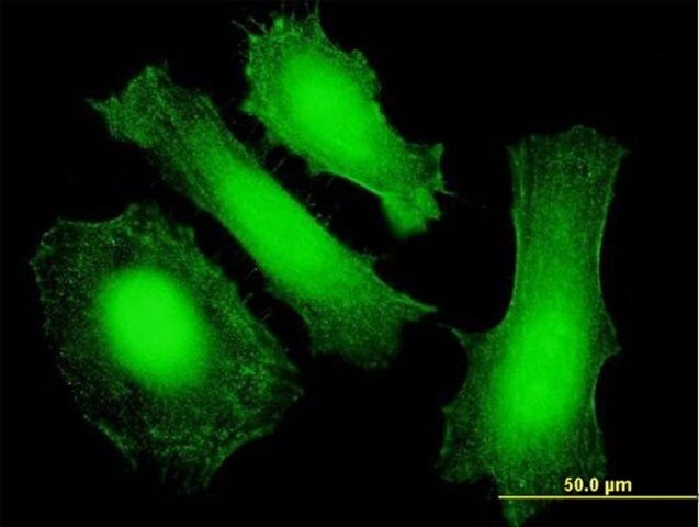 Anti-LIN28 antibody produced in mouse