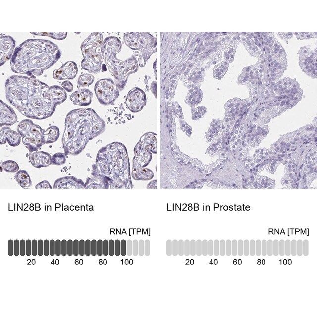Anti-LIN28B antibody produced in rabbit