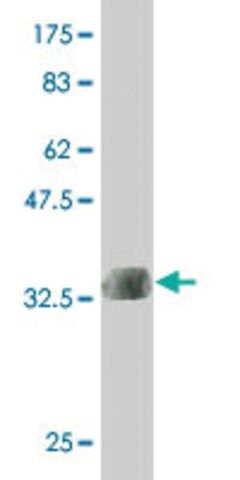 ANTI-LMTK3 antibody produced in mouse