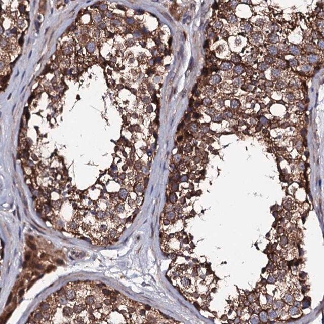 Anti-LIPT2 antibody produced in rabbit