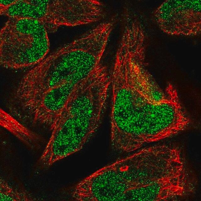 Anti-LINS1 antibody produced in rabbit