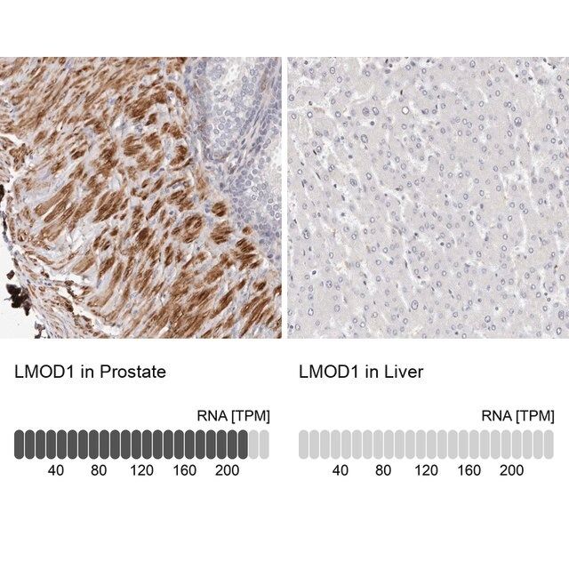 Anti-LMOD1 antibody produced in rabbit